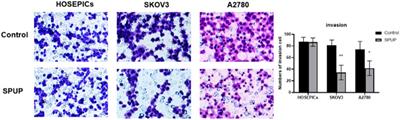 Sulfated Polysaccharide From Undaria Pinnatifida Induces Apoptosis and Inhibits Proliferation, Migration, and Invasion in Ovarian Cancer via Suppressing the Hedgehog Signaling Pathway